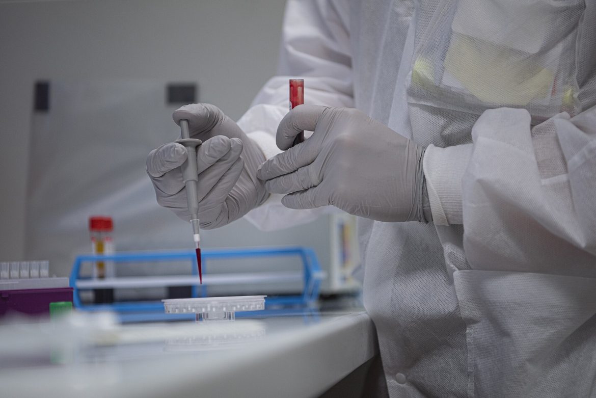 Blood test samples in a laboratory used in Alzheimer's risk research